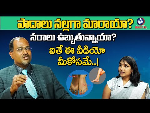 నరాలు ఉబ్బుతున్నాయా? | Gnaneshwar Rao Explains Varicose Veins | Telugu Health Tips | Mic Tv Health
