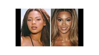BEYONCE  nose job + skin bleaching