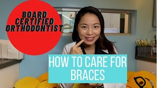 Everything you need to know about getting BRACES