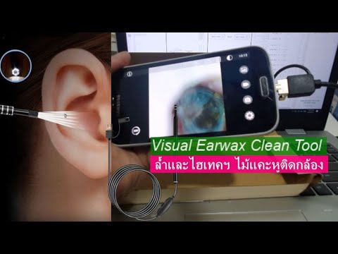 Visual Ear Wax Clean Tool  รีวิวไม้แคะหูไฮเทค มองเห็นภาพภายในหู