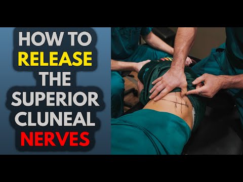How To Release Superior Cluneal Nerve Entrapments with Adhesion Release Methods