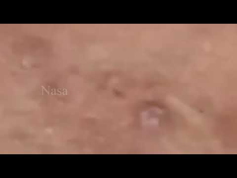 فيديو تنظيف البشره من الروس السودا