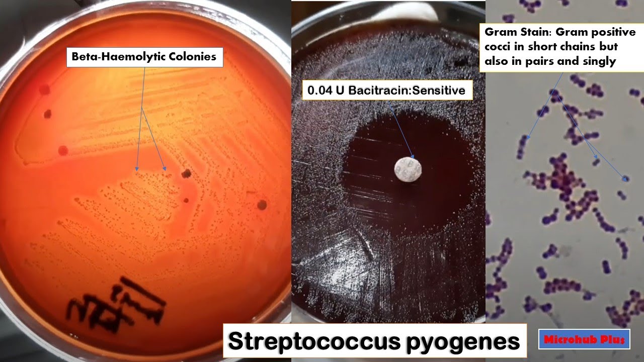 Тест стрептококк группы а. Streptococcus pyogenes на питательной среде. Стрептококки Бацитрацин тест.