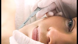 Dermaplaning Lansdowne Secrets Exposed - Best Dermaplaning Facial Lansdowne MedSpaLookUp
