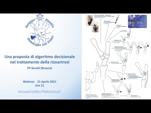 P.P. BORELLI: Una proposta di algoritmo decisionale nel trattamento della rizoartrosi  