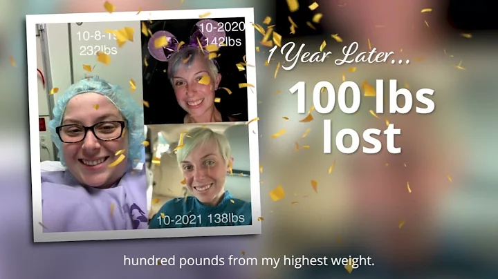 Weight Loss Surgery - Laura Falvey Prospective