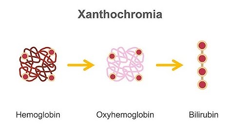 Analyzing gross appearance and cell count of cerebrospinal fluid
