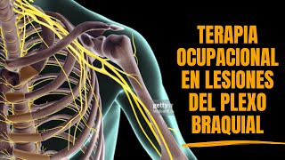 Terapia Ocupacional en Lesión del Plexo Braquial Terapia Ocupacional en Lesión del Plexo Braquial