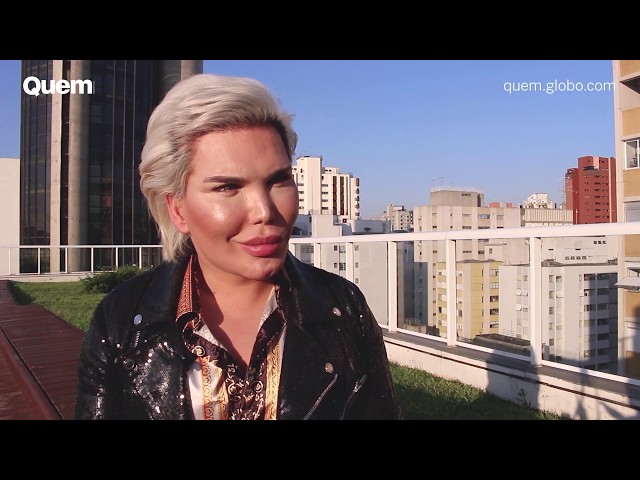 Rodrigo Alves rejeita rótulo de Ken Humano e fala de plásticas, bullying e  autoestima 