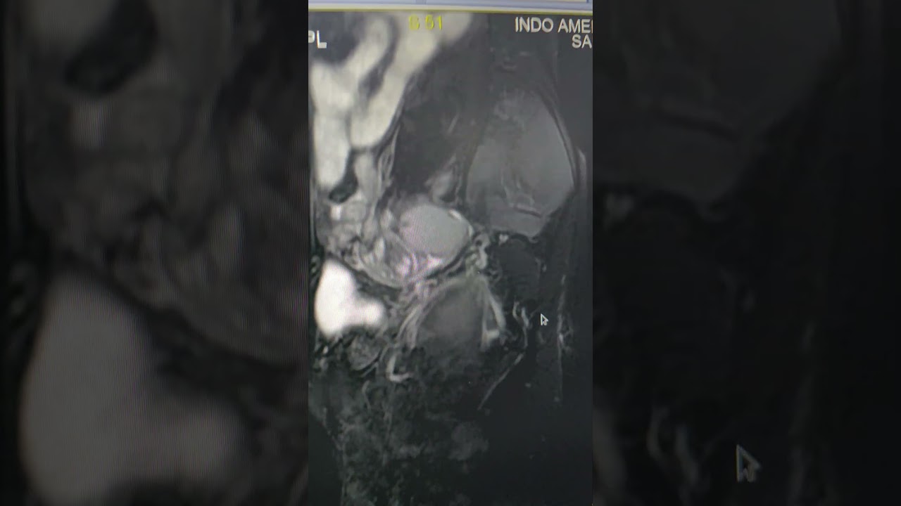 indo American hospital