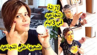 وصفة جبارة لإزالة التجاعيد #والكلف وانتفاخ تحت العين#غادي يولي وجهك كأنك في 20من عمرك