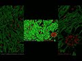 Confocal microscope images of live and dead cells #confocal #microscope #staining #cell #imaging
