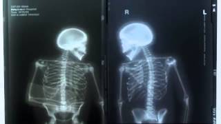 Metro Imaging Commercial 3 - Michael Wollner