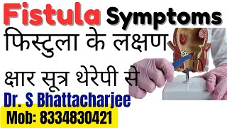 Fistula ke lakshan | जानिए फिस्टुला के लक्षण | kya aapko fistula ke lakshan hai?