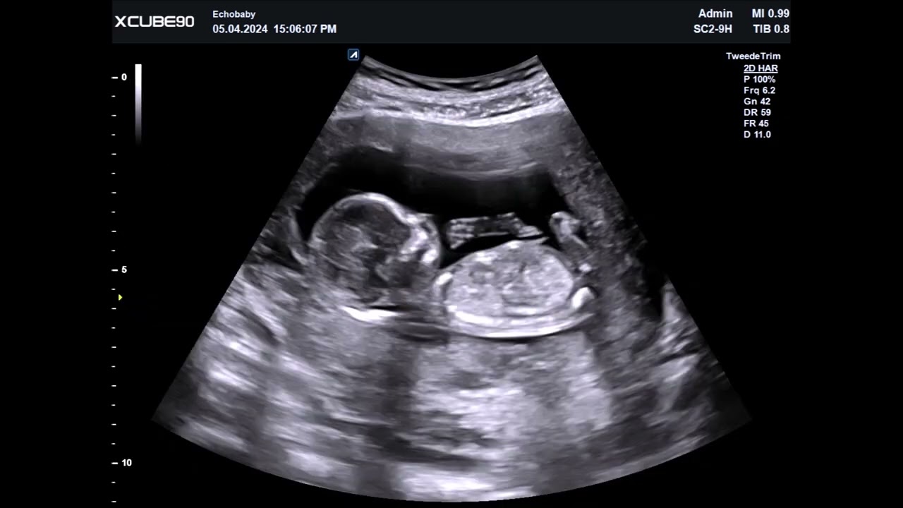 Pretecho 14 Weken Foto's