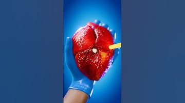 How An Autopsy Is Performed 😨 Surgeon Reacts