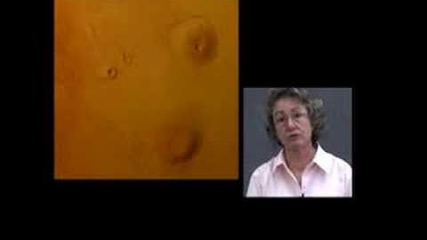 Exploring Deep-Subsurface Life: Introduction