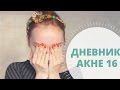 Дневник АКНЕкутана 16. Расходимся!