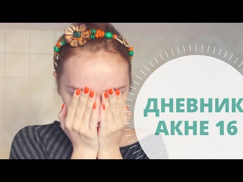 Дневник АКНЕкутана 16. Расходимся! Дневник АКНЕкутана 16. Расходимся!