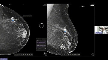 AI-assisted Diagnosis and Workflow Optimization