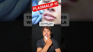 PlasmaLip All Natural Lip PLumper !!