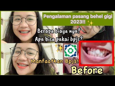 PENGALAMAN PASANG BEHEL GIGI 2023 DIBANTU BPJS? WAJIB TONTON PENGALAMAN PASANG BEHEL GIGI 2023 DIBANTU BPJS? WAJIB TONTON