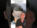 Which hair transplant procedure is best for you, you ask? #joerogan #hairtransplant #fue #fut