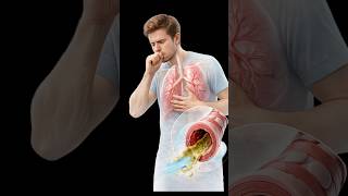 💊 Mucus remove karne wali drug pehchano! #shorts #viral #pharmacy
