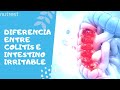 Diferencia entre colitis e intestino irritable