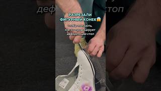 #фигурноекатание #фигуристка #коньки тг-канал: Regen Clinic | Спортивная медицина