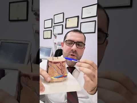 الدكتور عمرو الحمصي يشرح بالتفصيل عن الفراكشنال ليزر وعن تجويف العيون