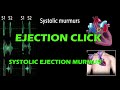 Ejection click and systolic ejection murmur pf heart sound