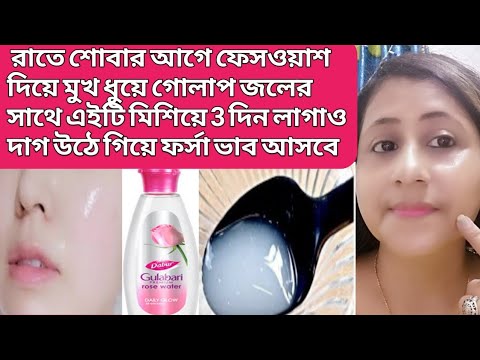 ভিডিও: শীতের আপেল গোলাপ