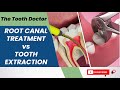 Root Canal vs. Tooth Extraction: Making Informed Dental Decisions