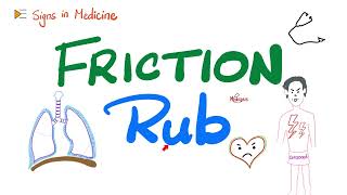 Friction rub...Pericarditis, pleurisy (pleuritis) | Signs in Medicine