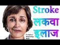 Stroke | What is a Stroke | Stroke kya hota hai | Stroke Treatment.