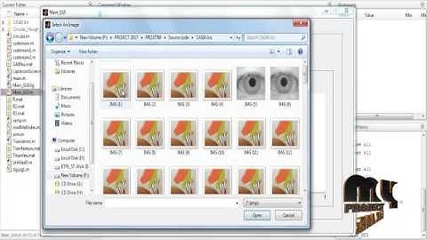 Iris recognition using combined support vector machine and Hamming | Final Year Projects 2016 - 2017
