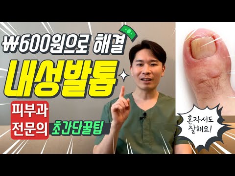 리얼한 내성 발톱 케어방법 | Ingrown Toenail treatment