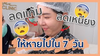 รีวิว!! ลดแก้ม เหนียง ให้หายไปใน 7 วัน