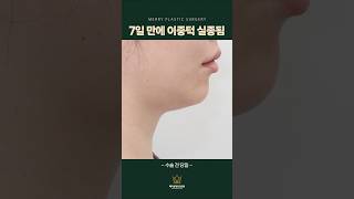 이중턱, 7일이면 충분하대요 (실화주의)