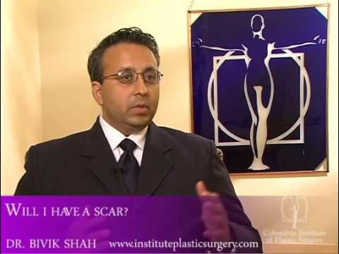 Scarring Concerns, Cosmetic Surgery FAQ – Dr.  Rivik Shah