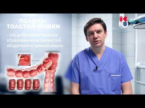 👨‍⚕️Полипы толстой кишки. Эндоскопическая полипэктомия. Врач проктолог.