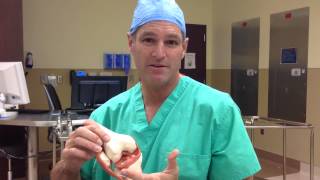 What is the ACL, Where is The ACL, and ACL Tears
