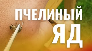 ПЧЕЛИНЫЙ ЯД. МОЙ ЛИЧНЫЙ ОПЫТ ПЧЕЛОУЖАЛИВАНИЯ