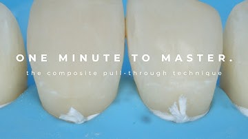 One minute to master - the composite pull-through technique