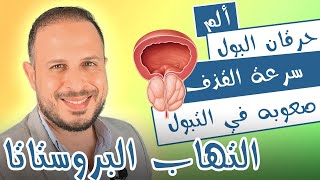 إحتقان البروستاتا وتأثيرها علي صحة الرجل | العلاج بالاعشاب والادوية