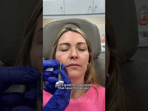 Polynucleotides Philart Eye Dr Medispa