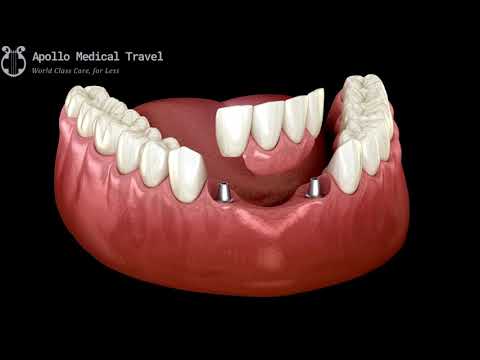 Animated Partial Fixed