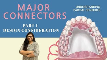 Major Connectors | Design Considerations | PART 1 | Dr. Rashmi Singh