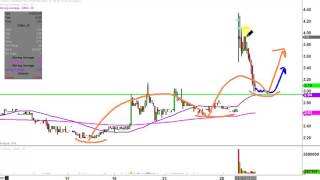 CombiMatrix Corp - CBMX Stock Chart Technical Analysis for 11-29-16